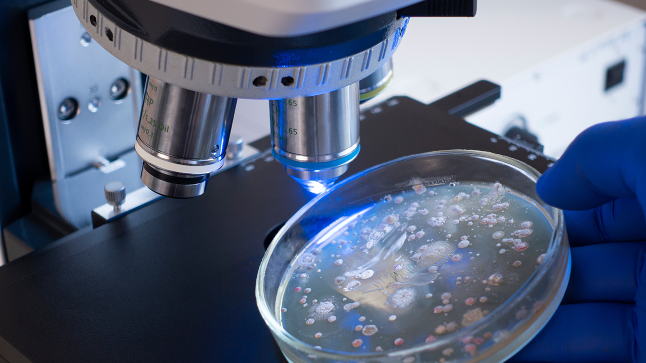 Der Wissenschaftler hält eine offene Petrischale mit Bakterienkolonien unter der Linse eines Mikroskops, eine Zunahme kleiner Mikroben unter einem Mikroskop